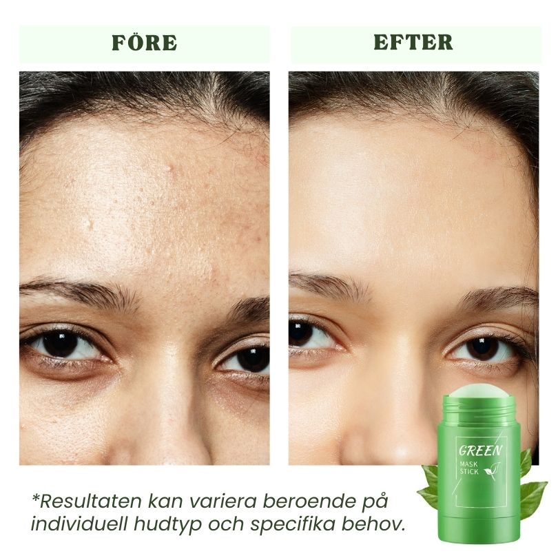 Dermaren™ Grönt Te Mask