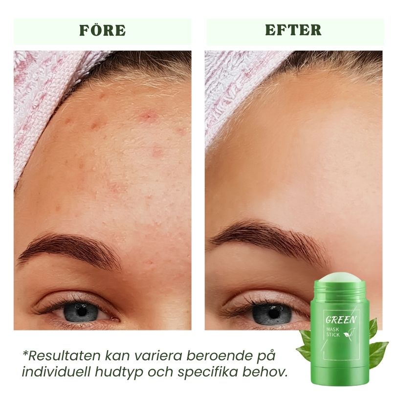 Dermaren™ Grönt Te Mask