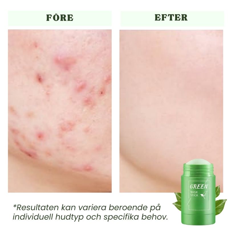 Dermaren™ Grönt Te Mask
