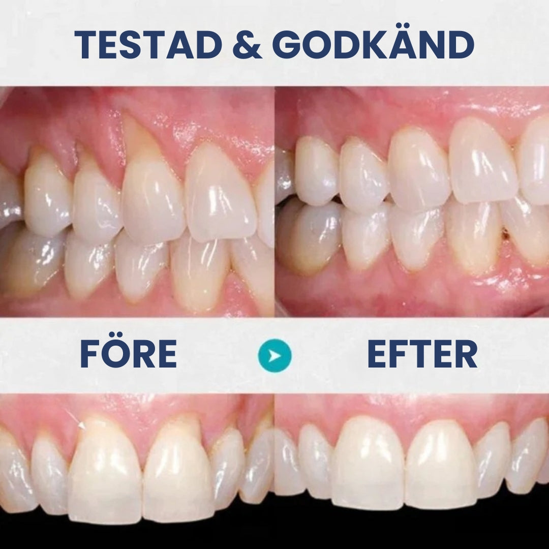 GumRädd™ Gum Gel