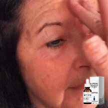 BotoxLjus™ Serum