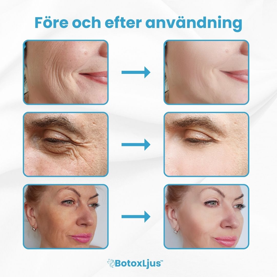BotoxLjus™ Serum