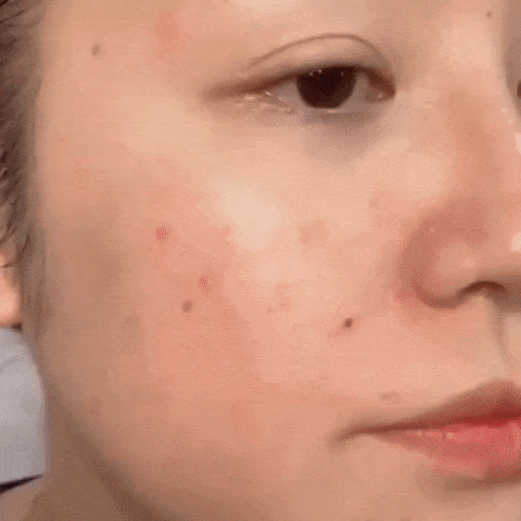 LysFix™ Fuktgivande Flytande Foundation