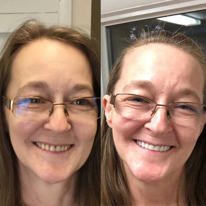 DentaLås™ Termoplastiskt Proteslim