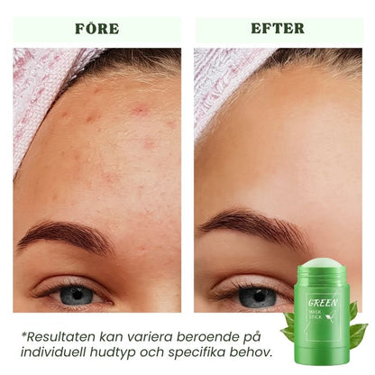 Dermaren™ Grönt Te Mask