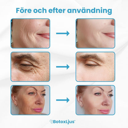 BotoxLjus™ Serum