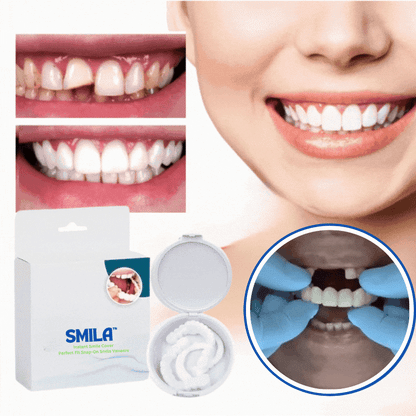 Smila™ Snap-On Tandprotes